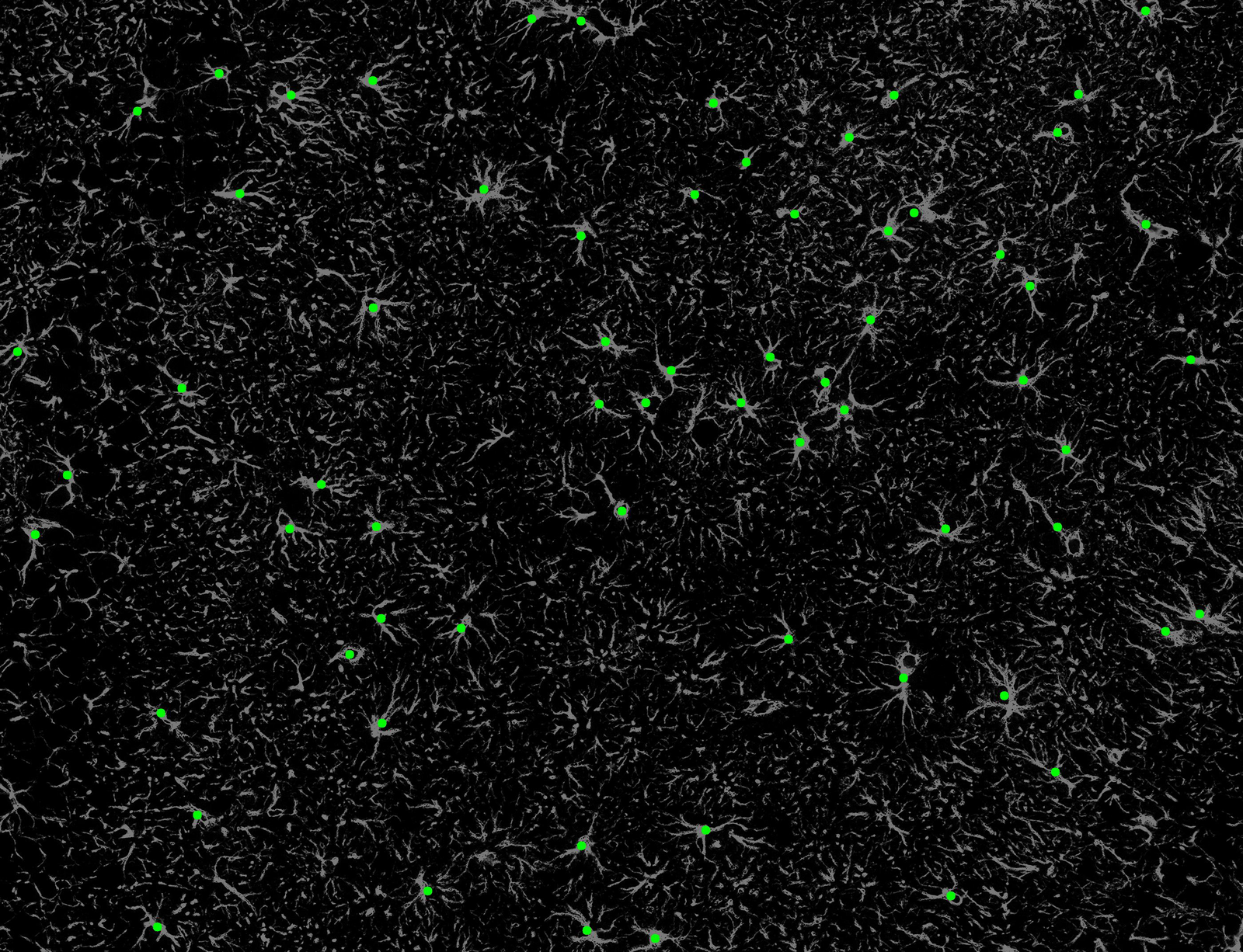 Automatic cell counting