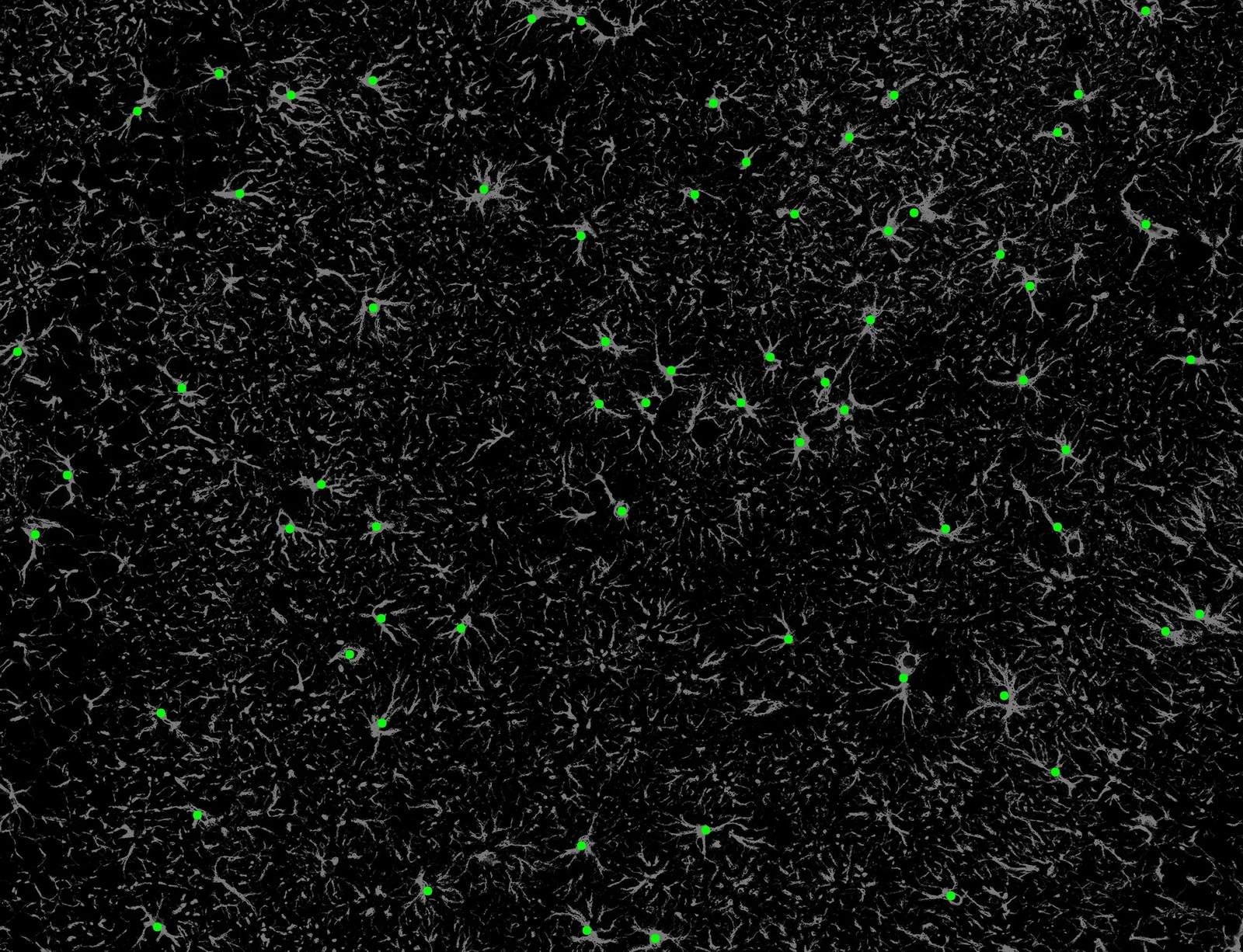 Automatic cell counting